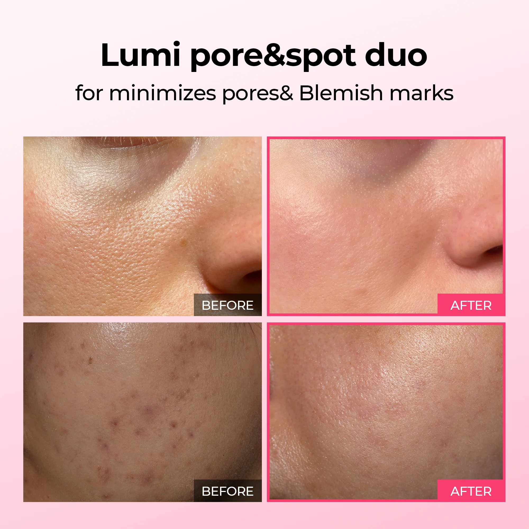 Lumi Pore & Spot Care Duo